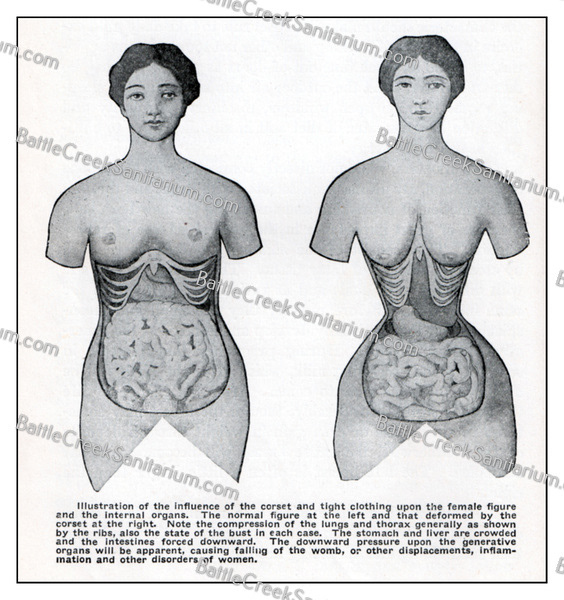 Misc-44 Dress reform Battle Creek Sanitarium
