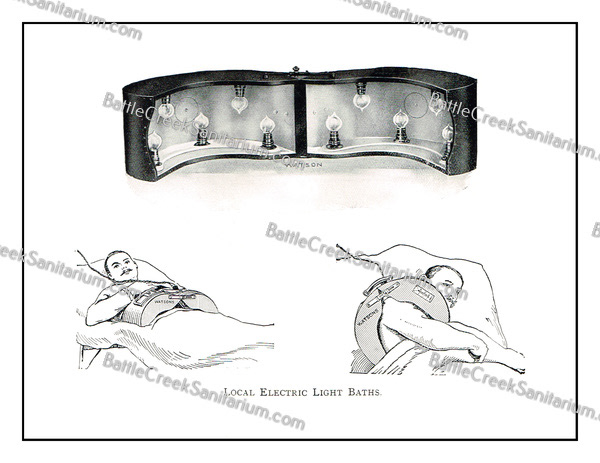 TI-176 Light Therapy at Battle Creek Sanitarium