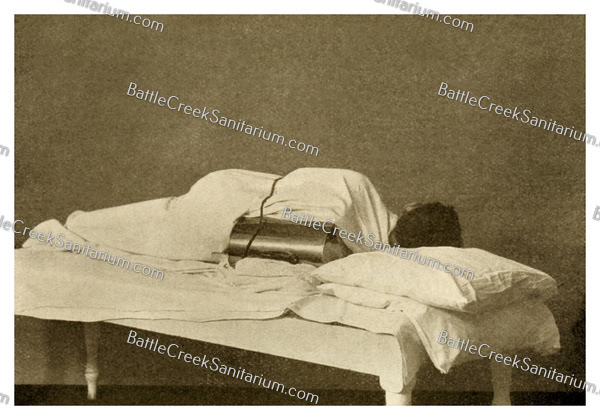 TI-167 Light Therapy at Battle Creek Sanitarium