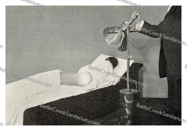 TI- 199 Light Therapy at Battle Creek Sanitarium
