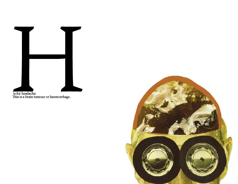 From the Hypochondriac's Alphabet. I also think about this sometimes.