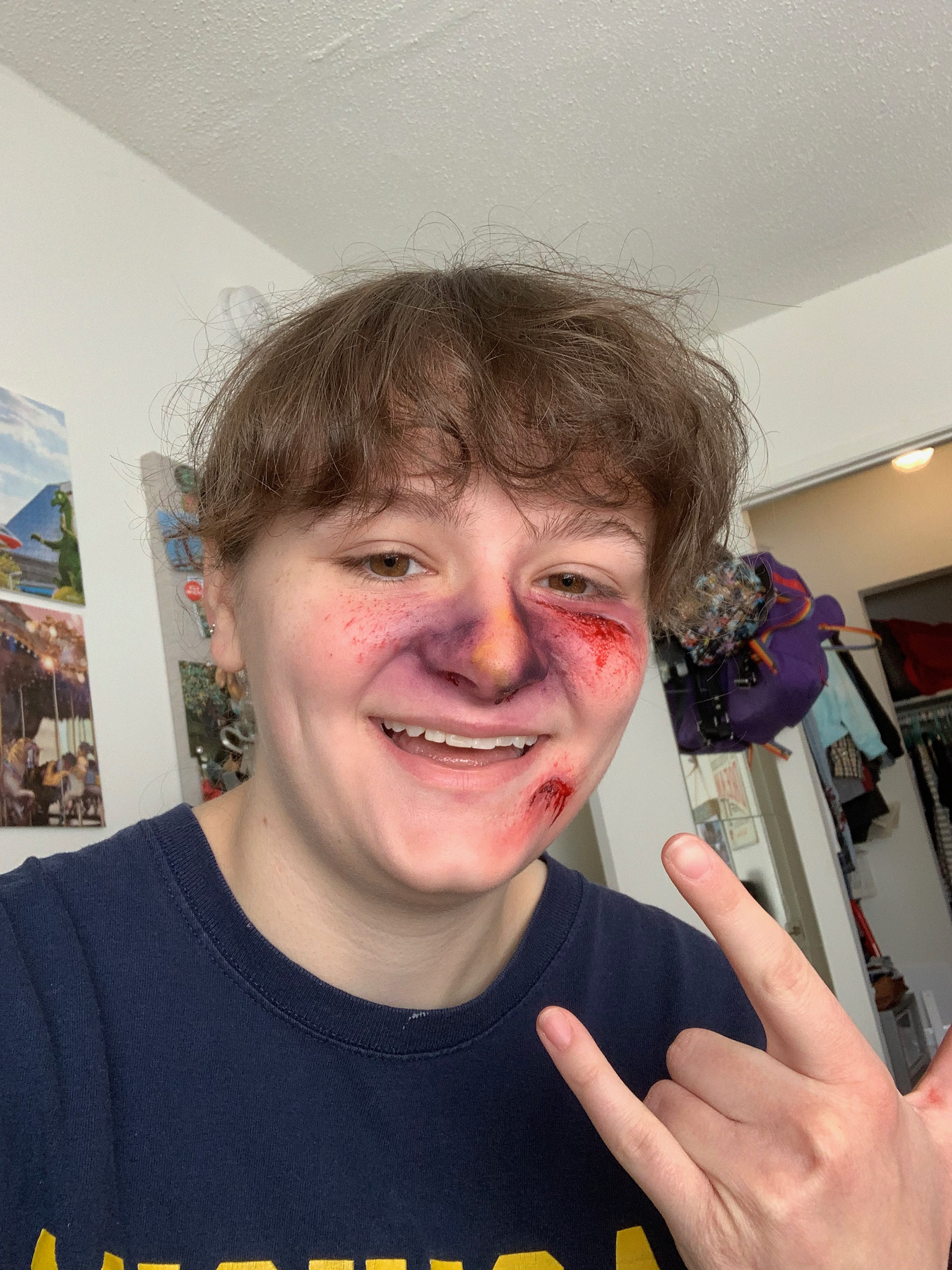 Broken nose and bloody face, first attempt
