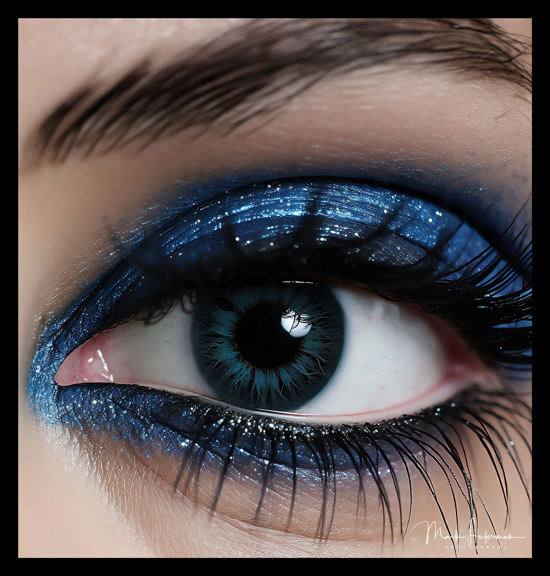 Eye