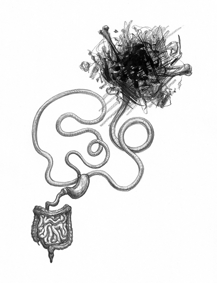 intestines winding around mass