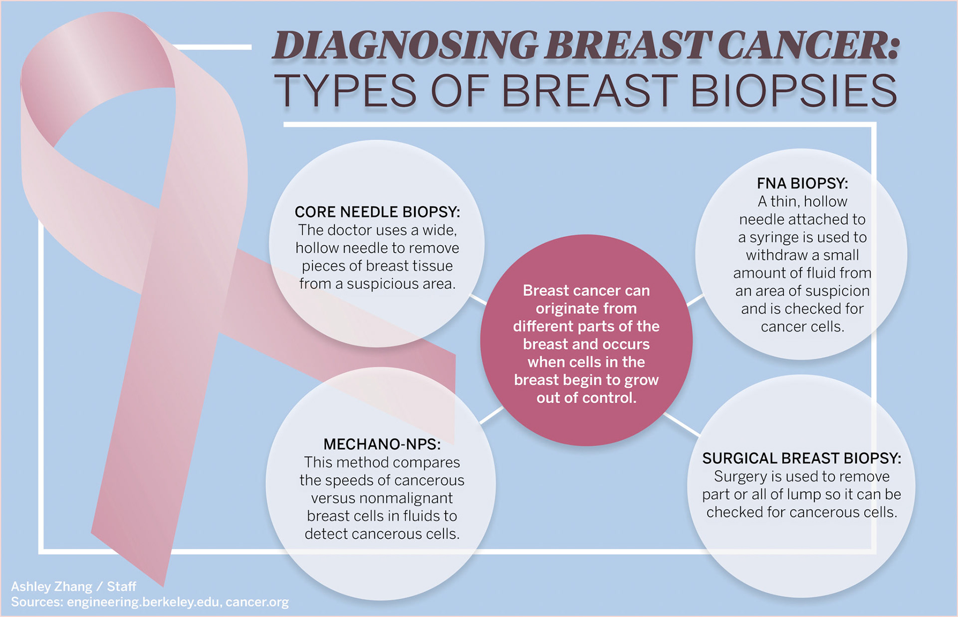 http://www.dailycal.org/2018/04/18/squeezing-cells-can-accurately-diagnose-breast-cancer-uc-berkeley-study-says/