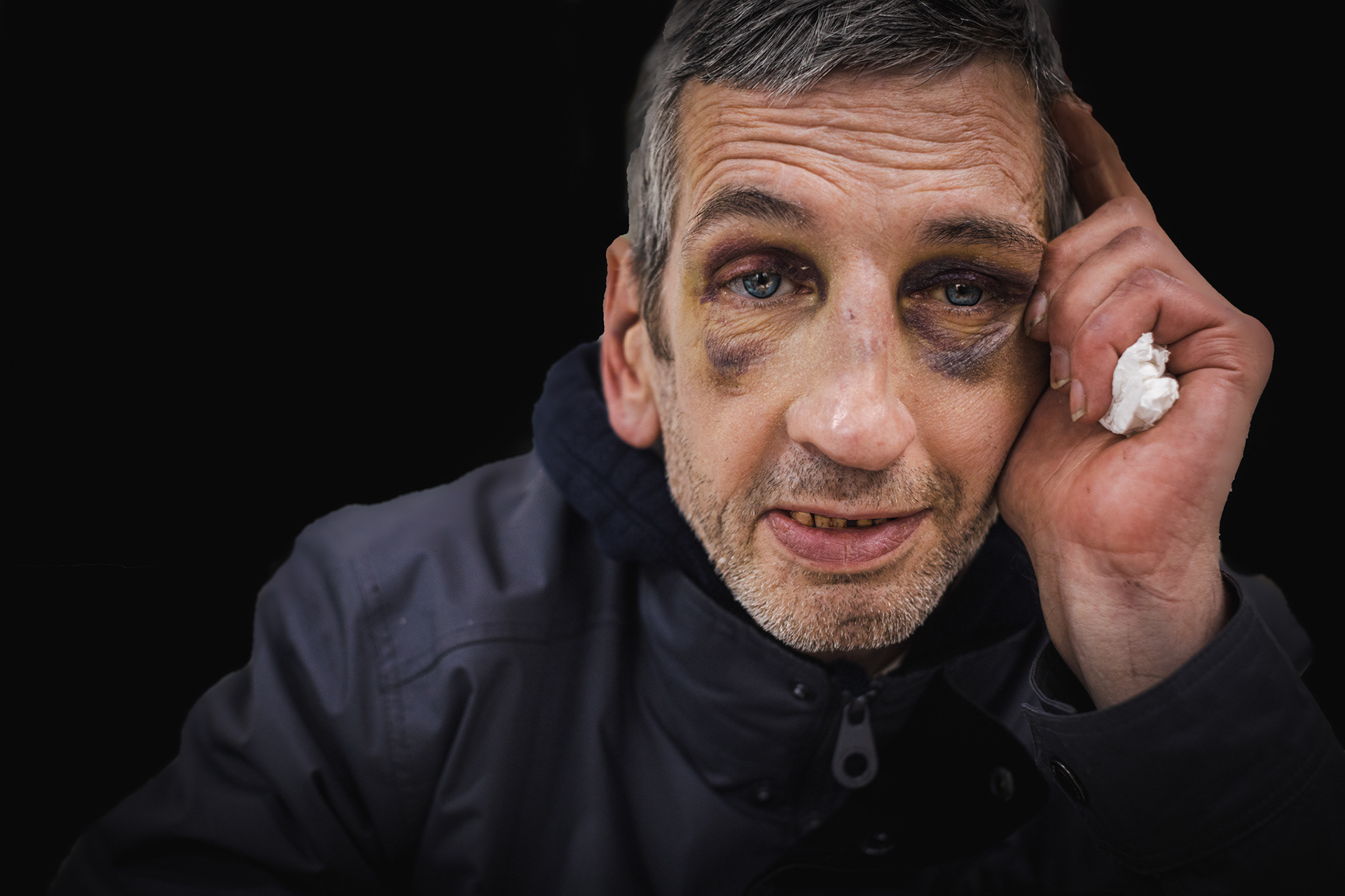 'You should see the other guy!'