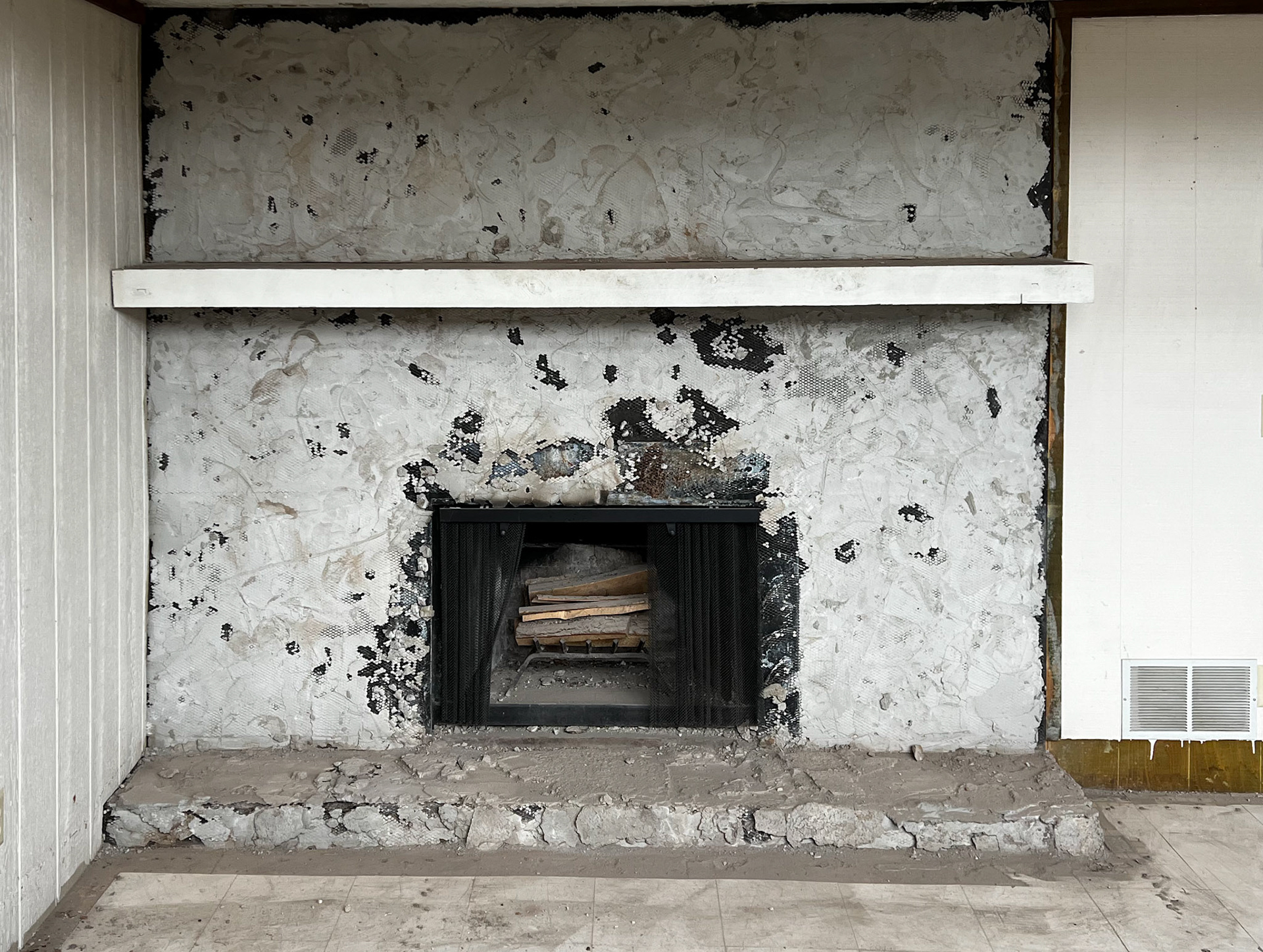 Stone Removal