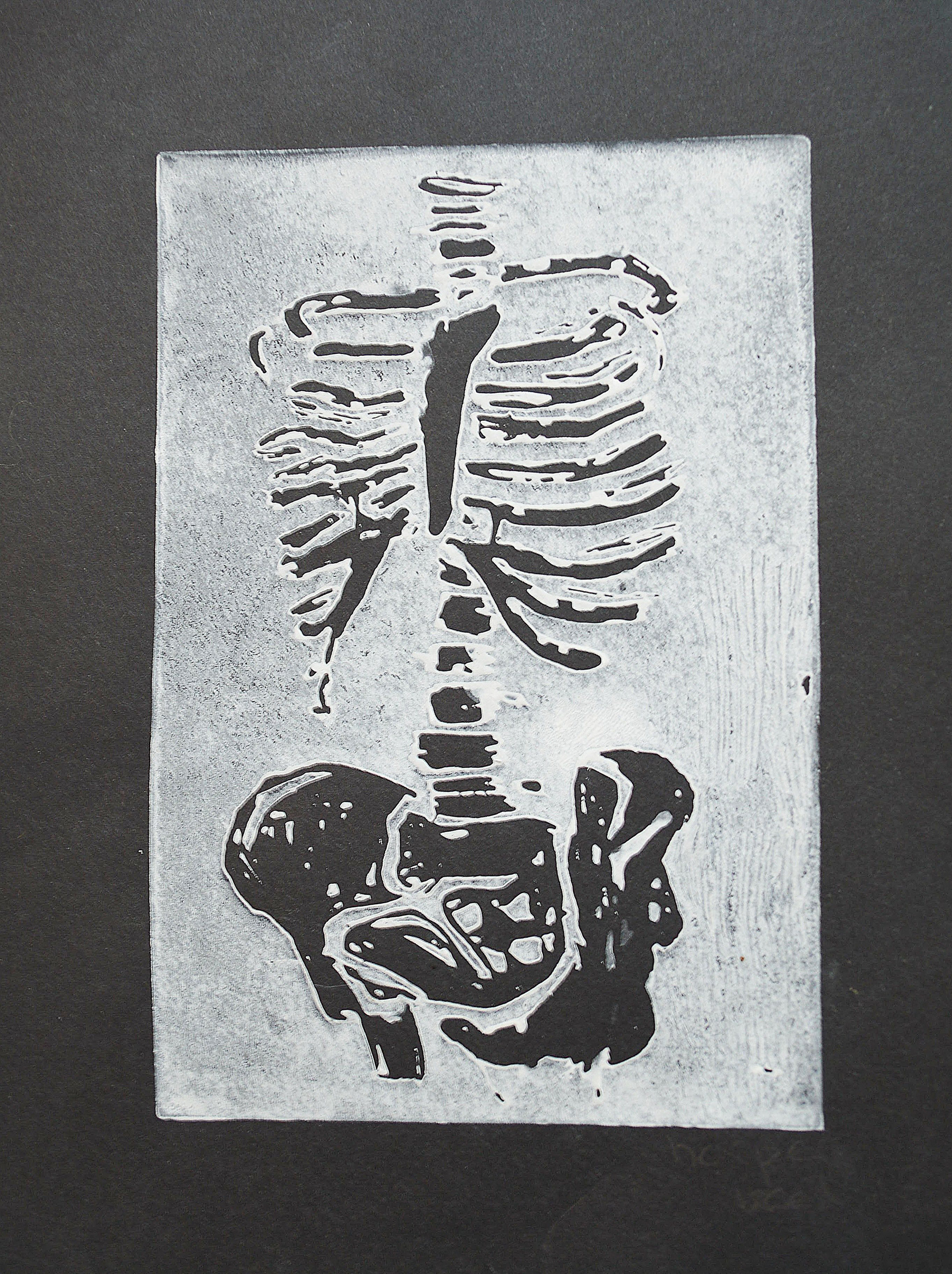 SKELETON