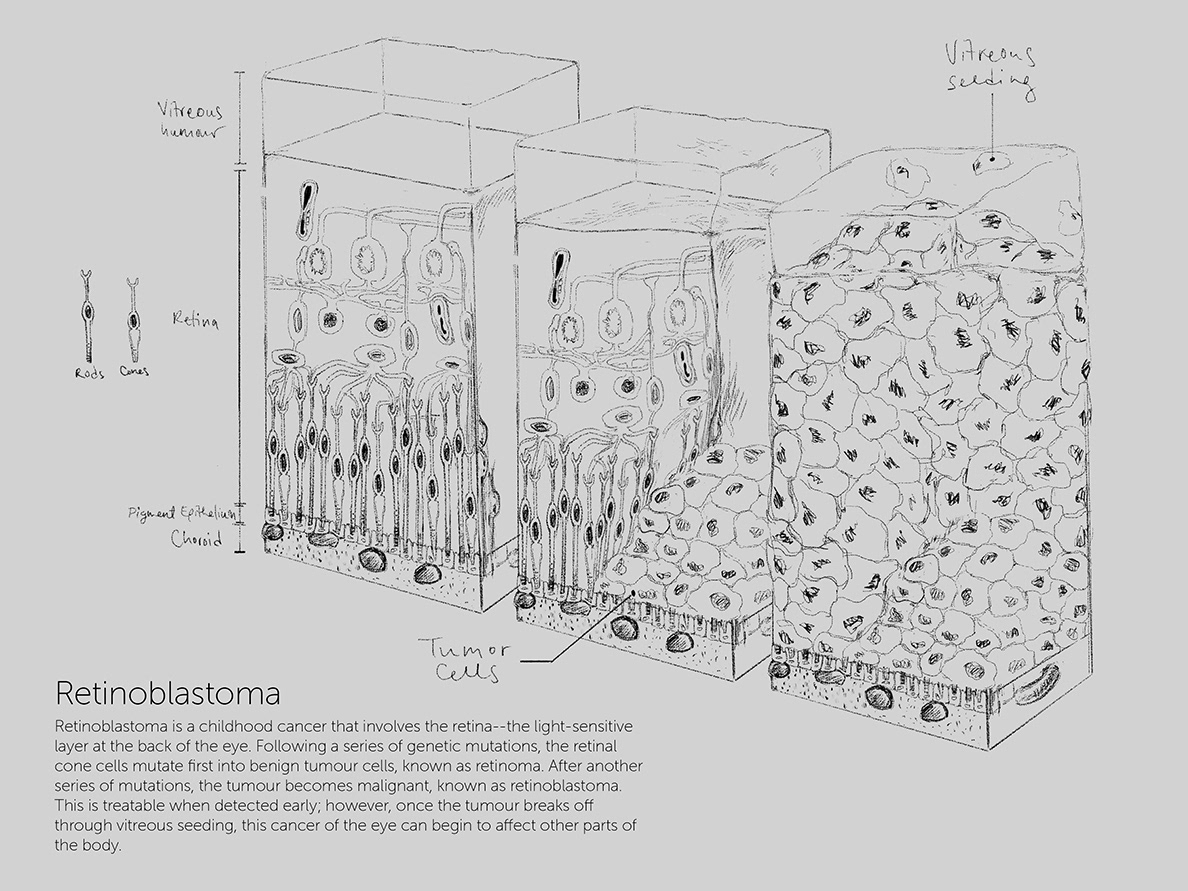 Tissue Cube Study