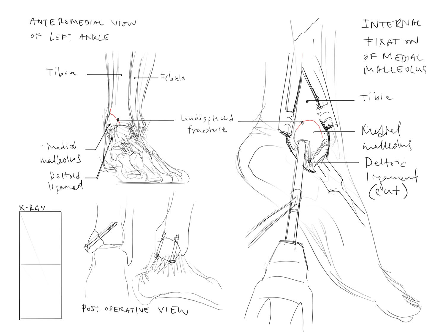 Concept Sketch