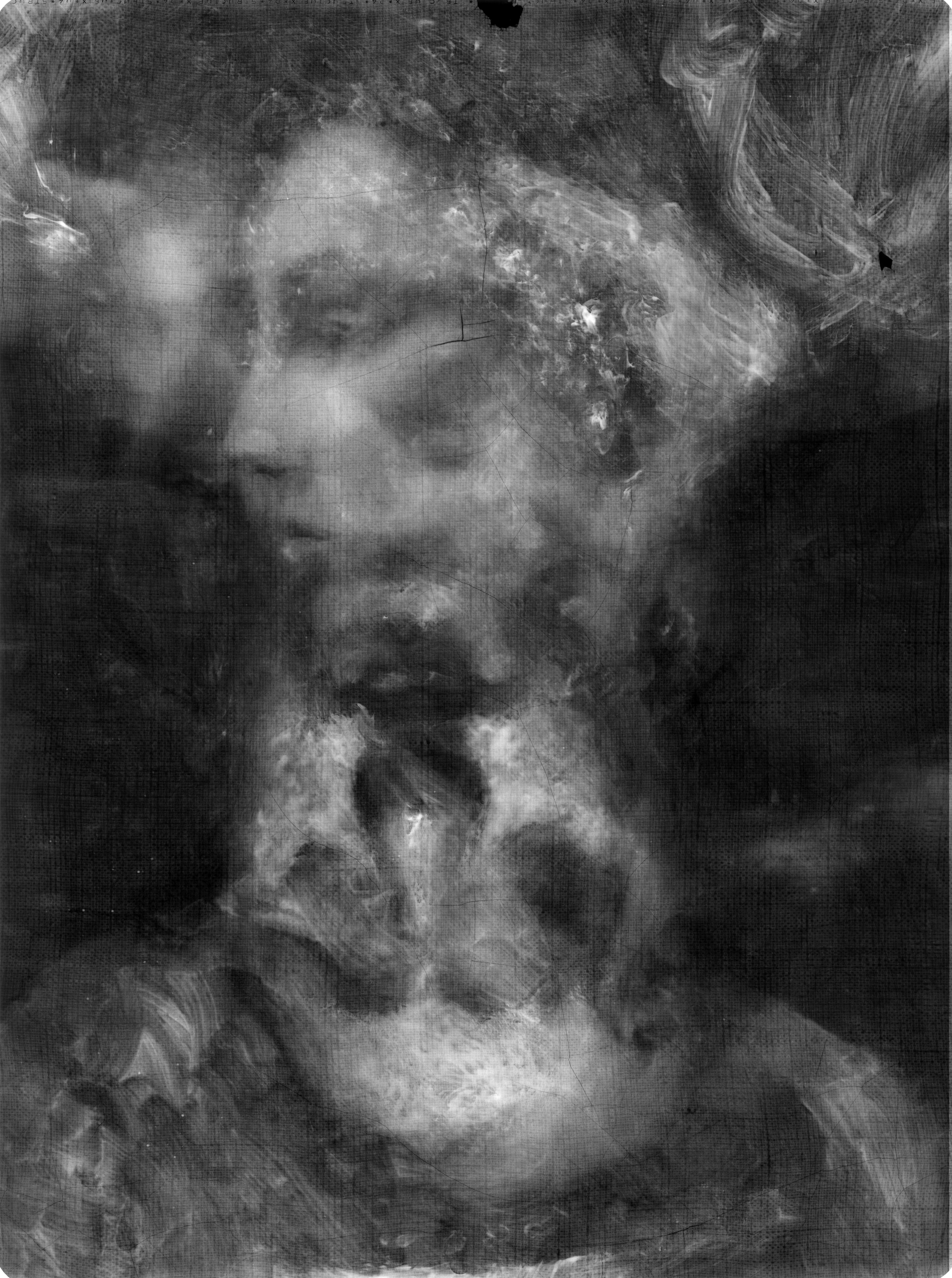 Radiographie inversée