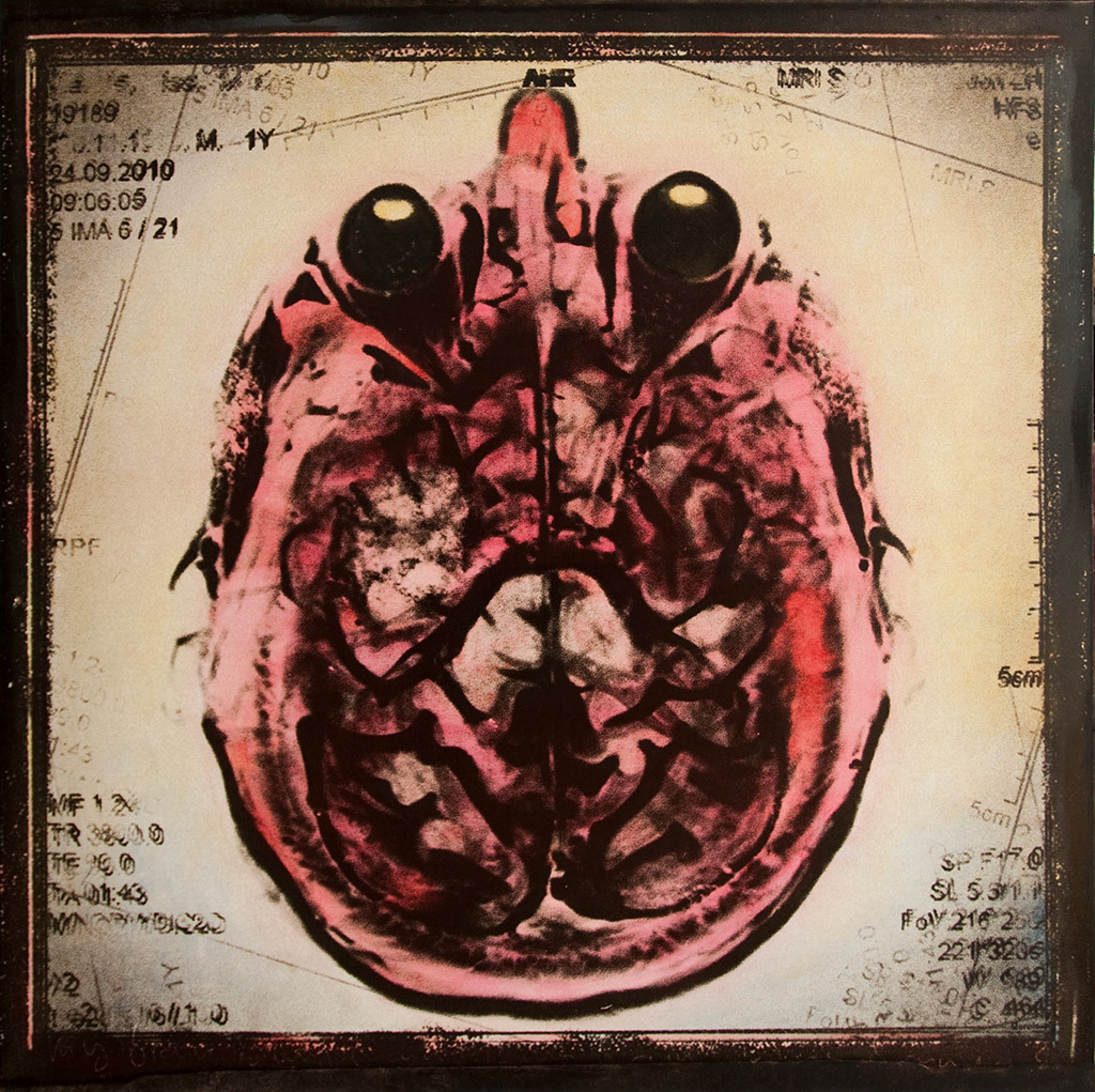 My brain is my brain is my brain