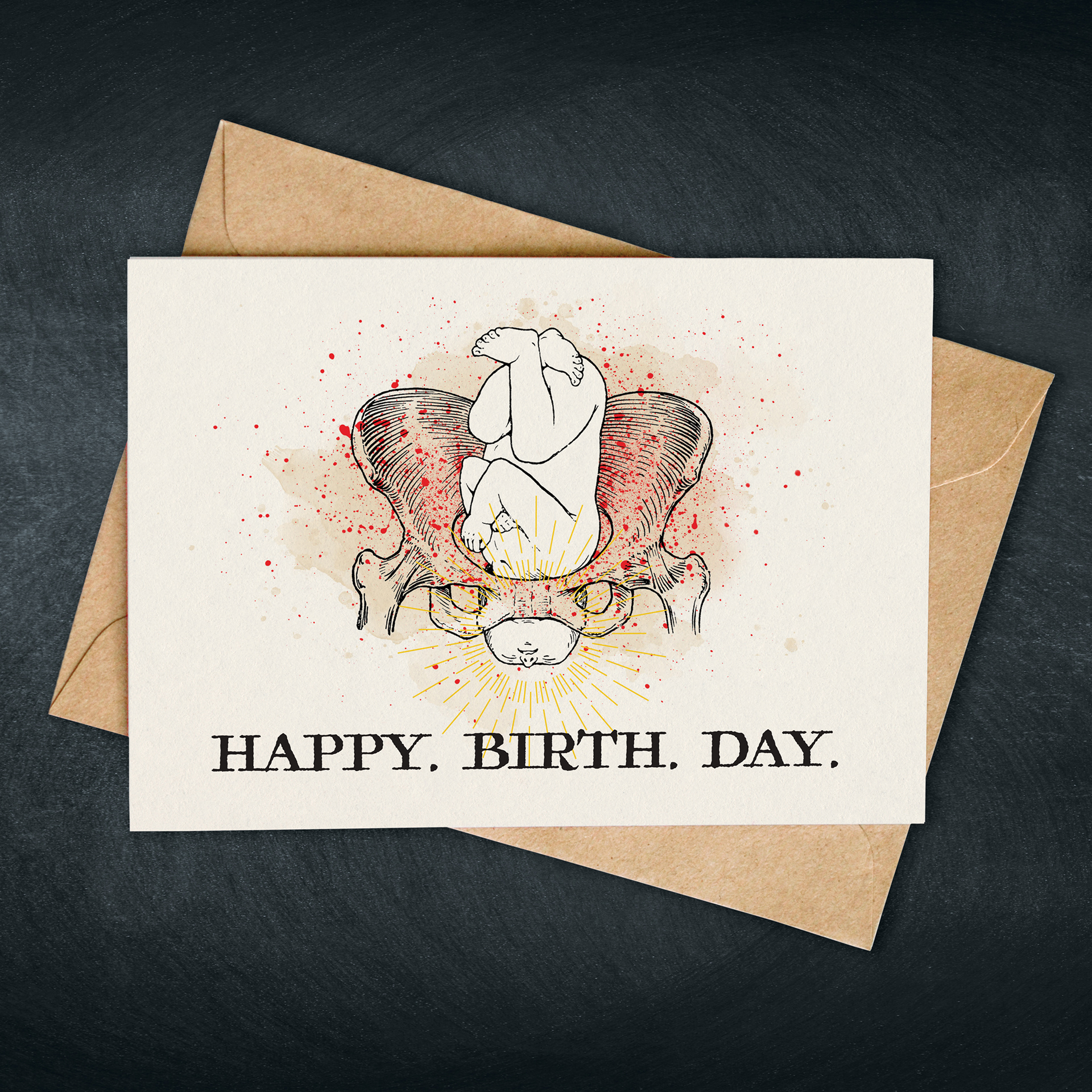 Satirical greeting card with a hand drawn image of a baby being born though a skeletal pelvis. Flesh color paint with red spashes and gold burst around the head.