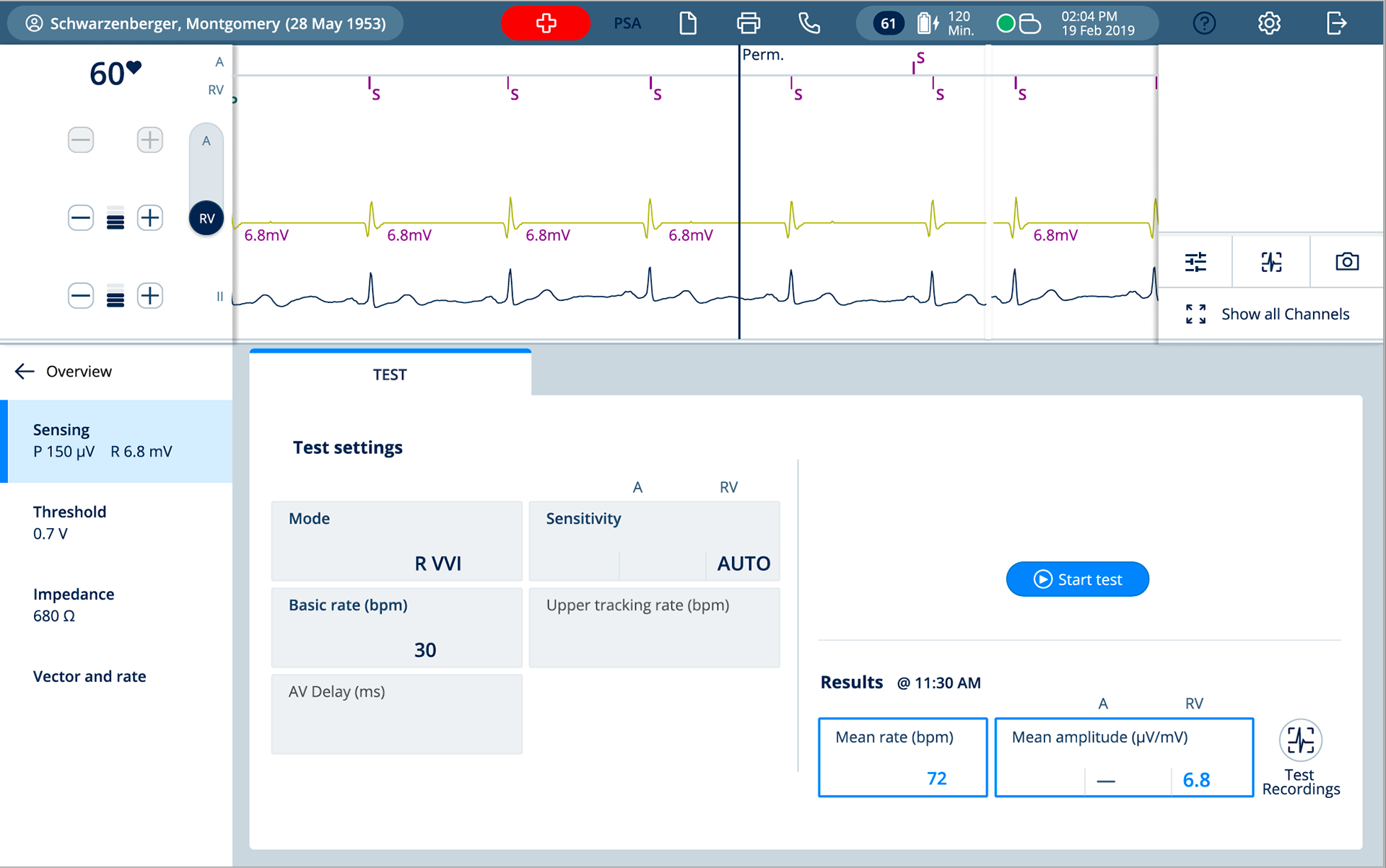 Sensing test ventricle 5