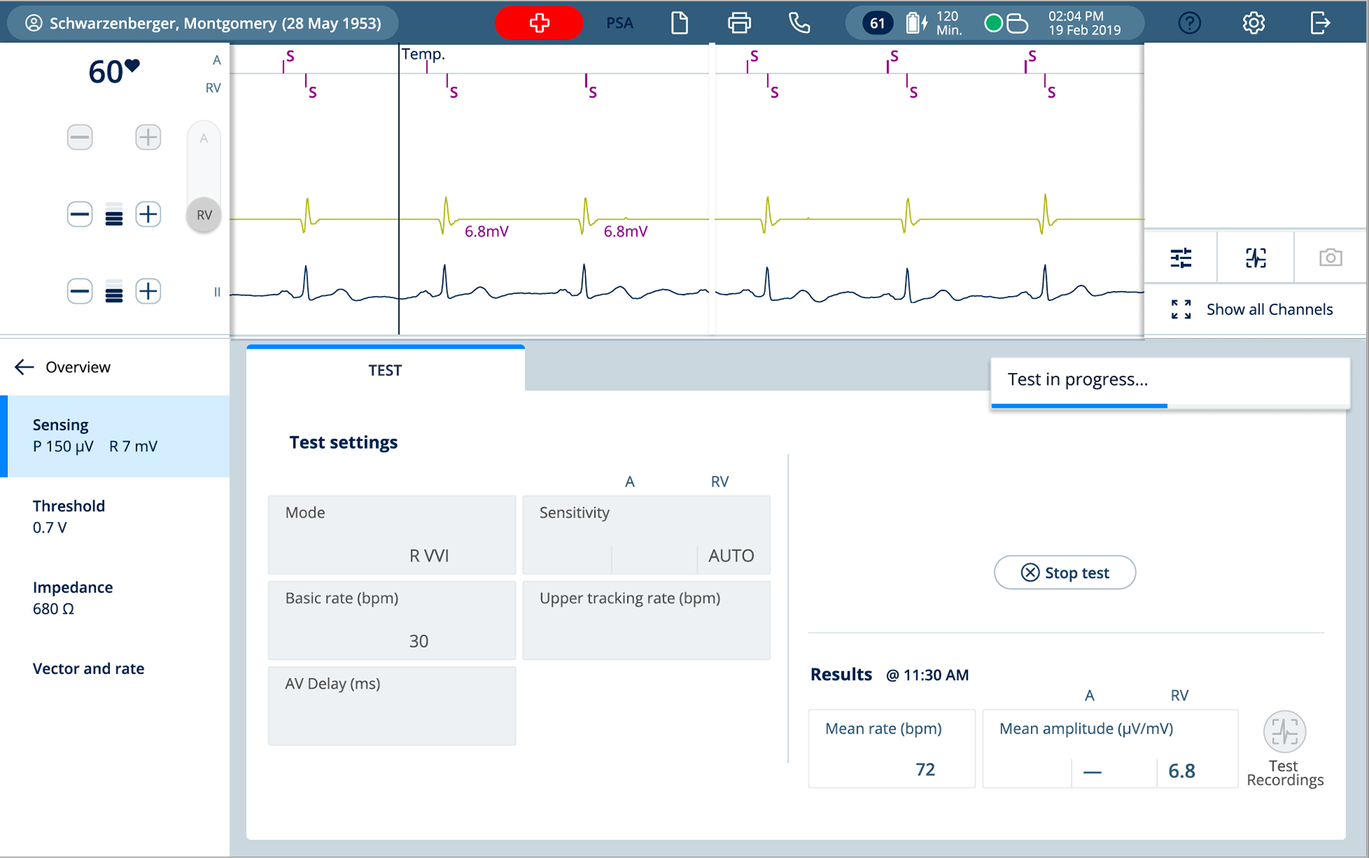 Sensing test ventricle 3