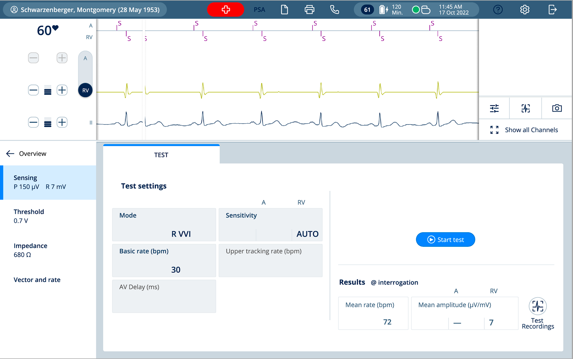 Sensing test atrial
