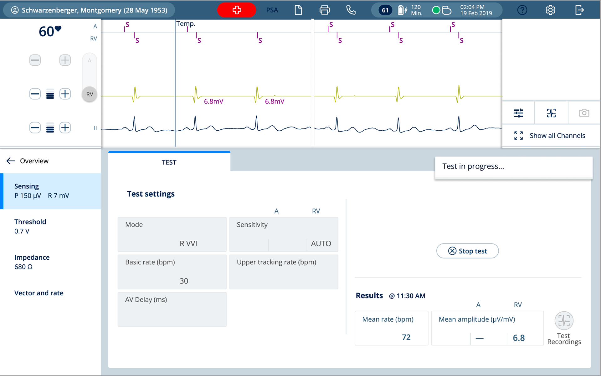 Sensing test ventricle 2