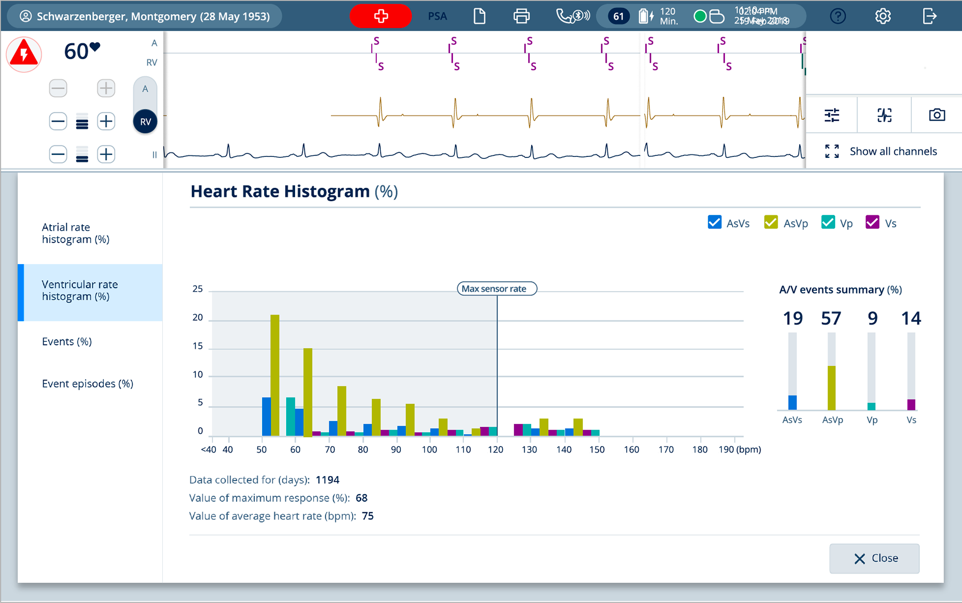 Ventricle rate histogram