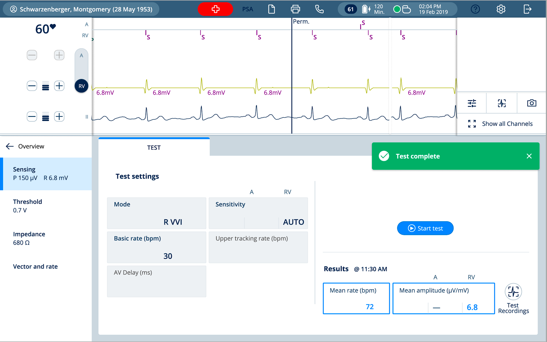 Sensing test ventricle 6