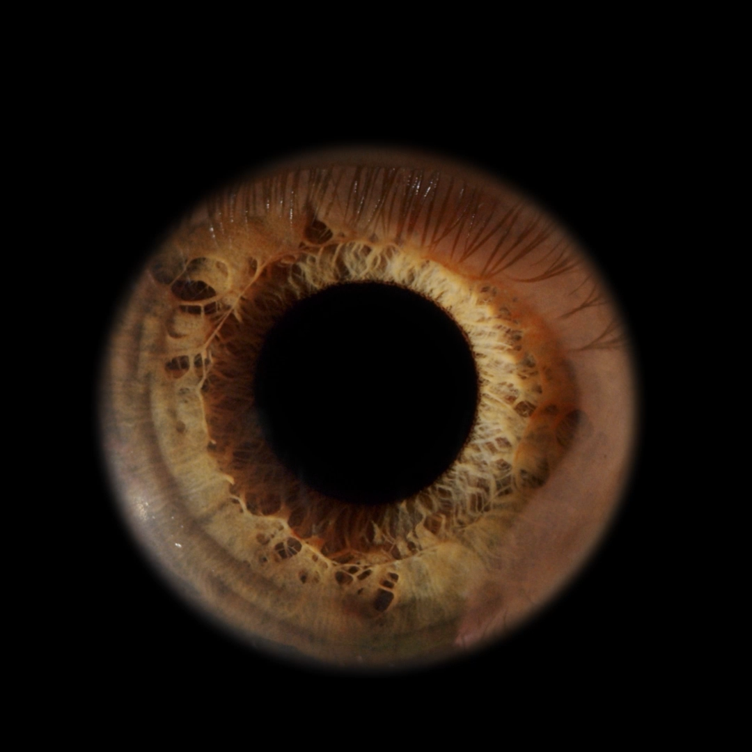 Blackhole
