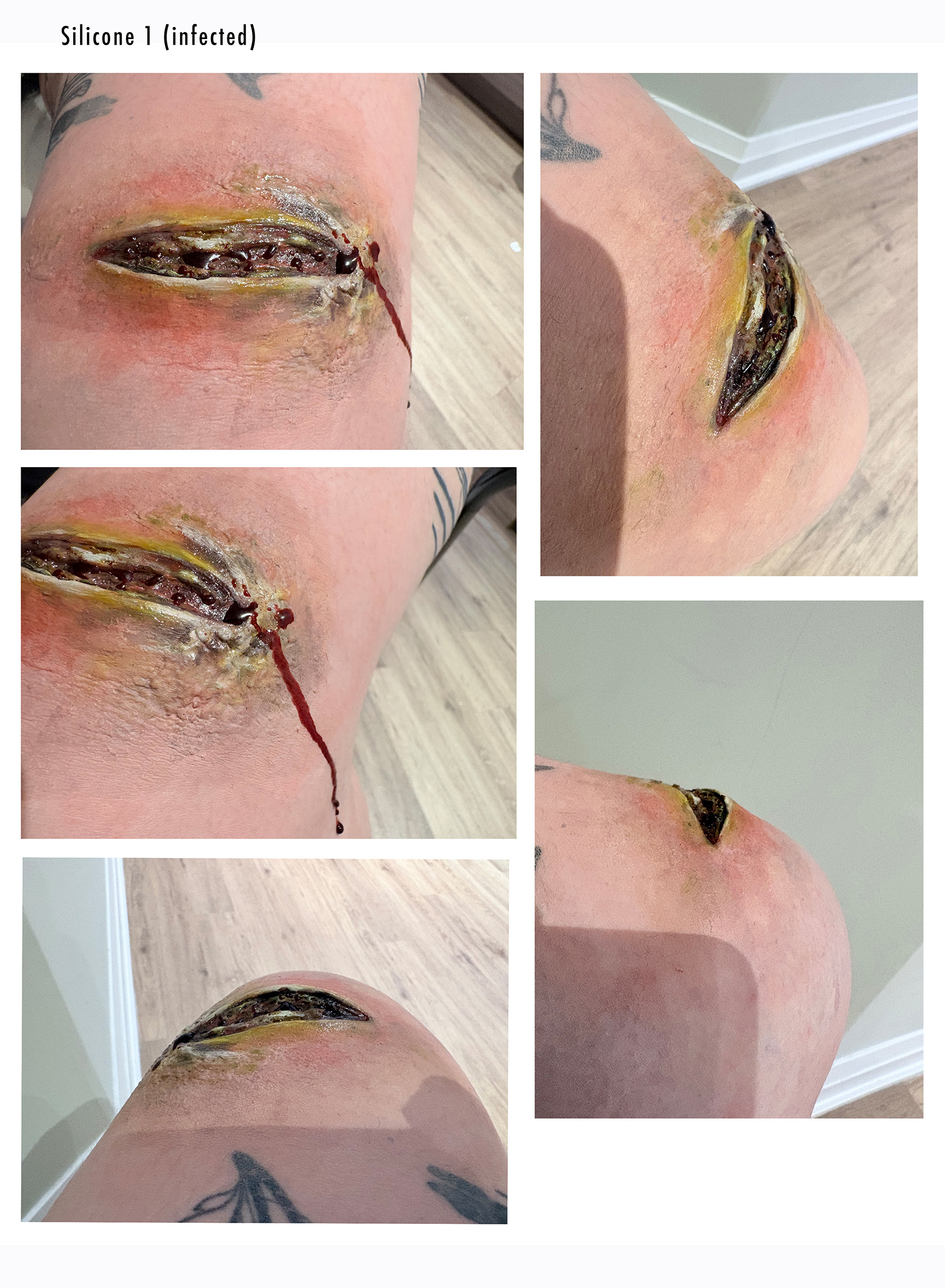 Infected Cut