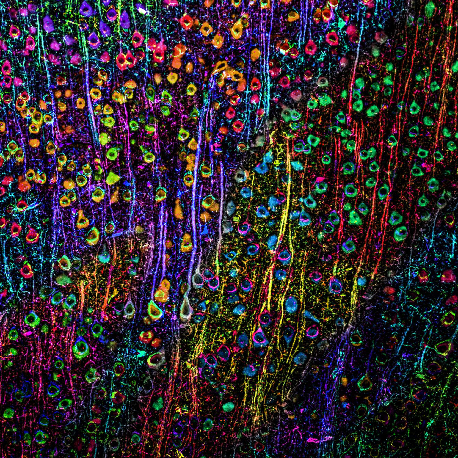 Flower Garden Series - Neuronal Flowers