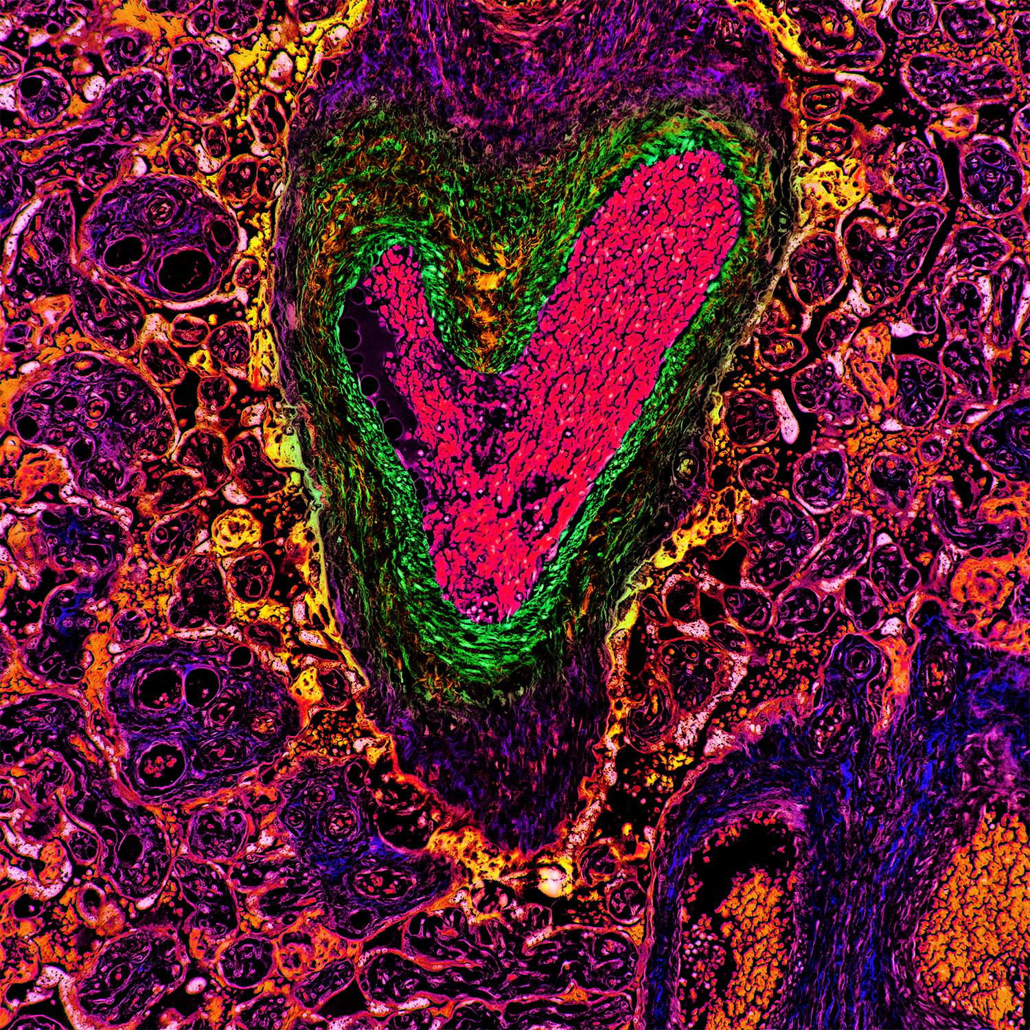 Human Placenta, Negative