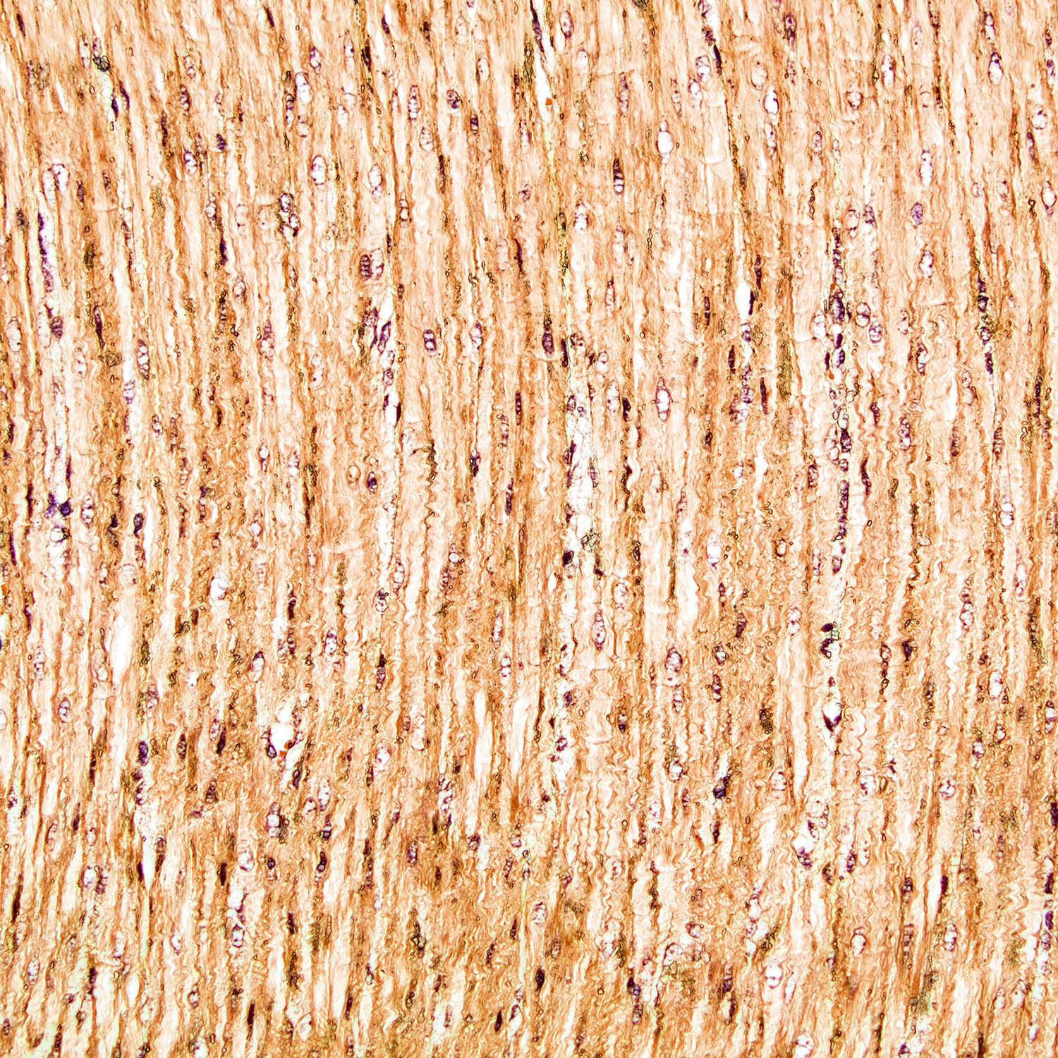 Pig Colon Muscle, Brightfield