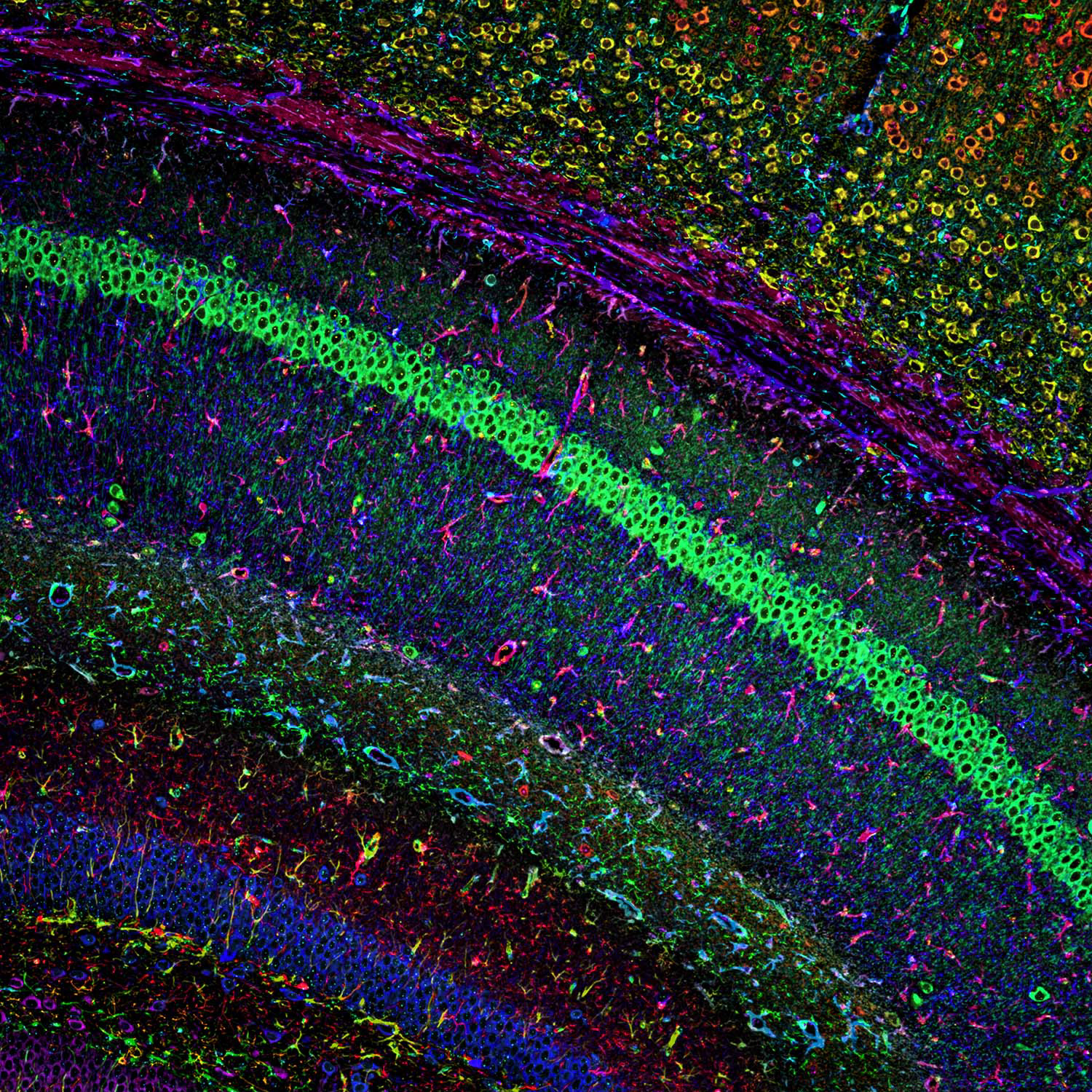 Mouse Brain, Fluorescence