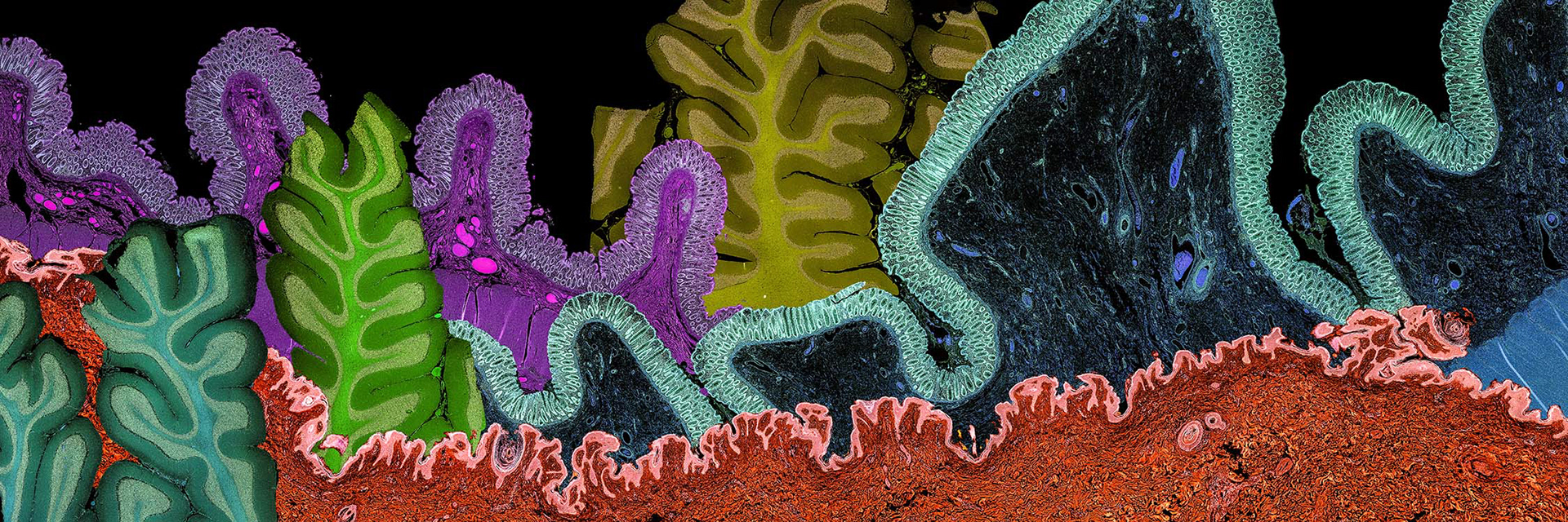 Human Cerebellum, Skin, and Colon Collage Panorama, Negative