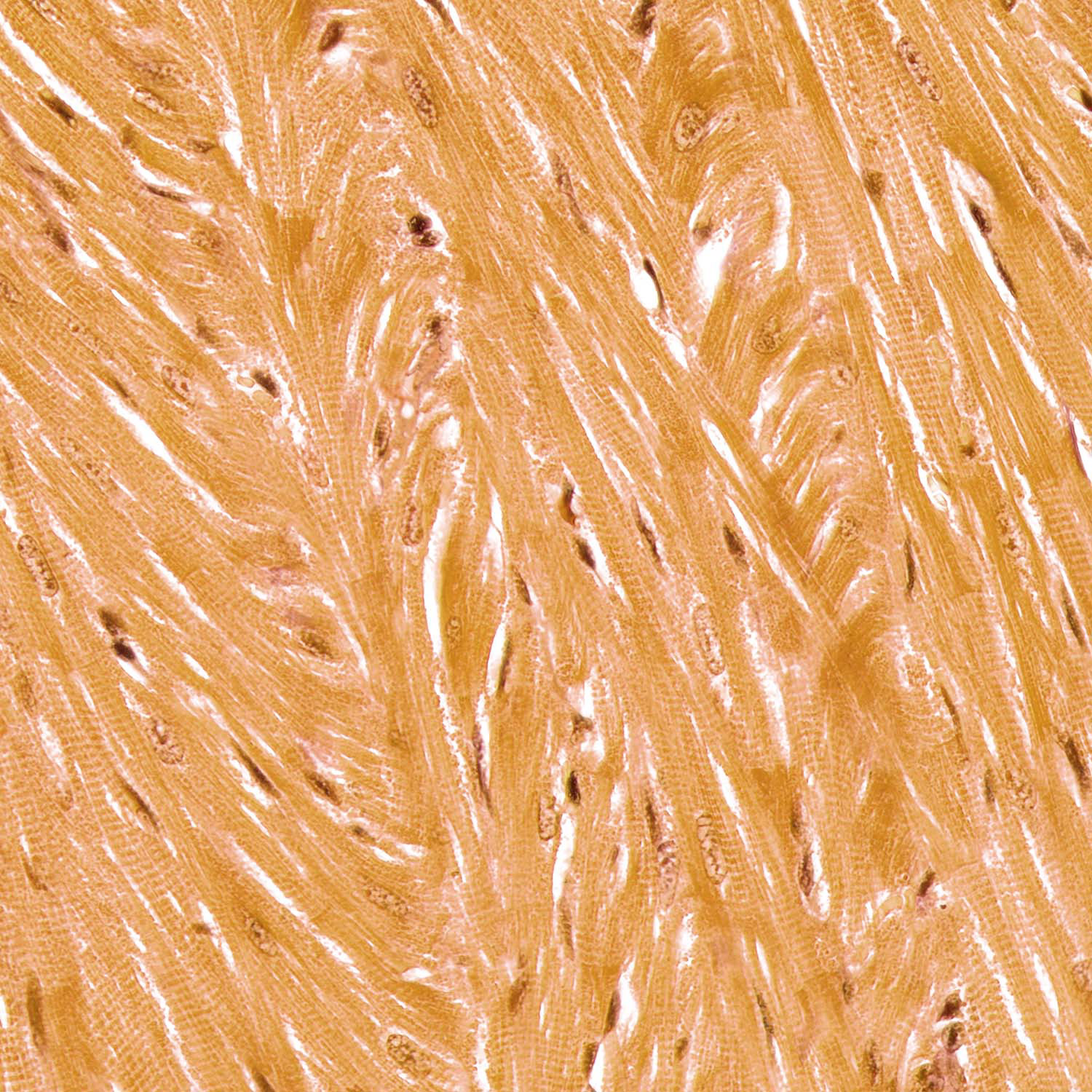 Rat Heart Muscle, Brightfield