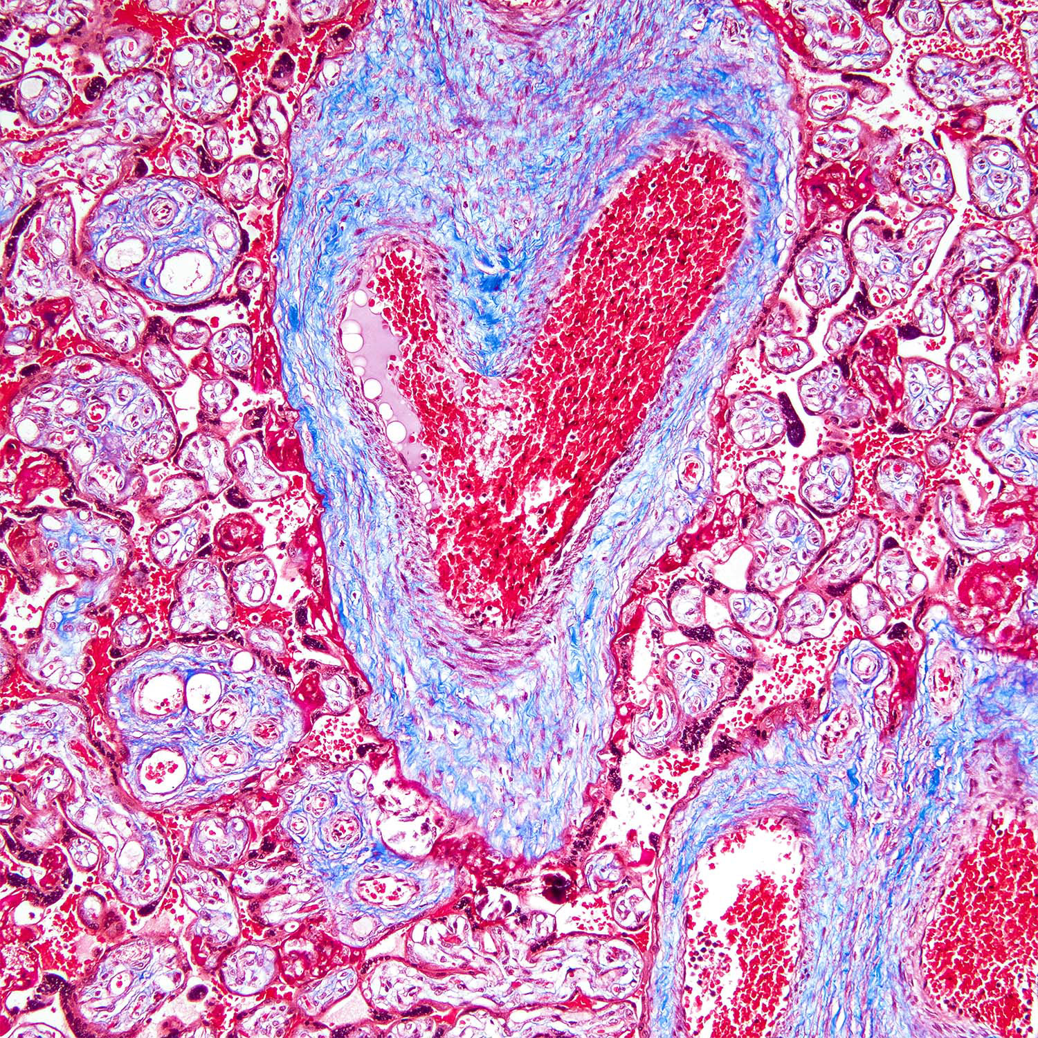 Human Placenta, Brightfield