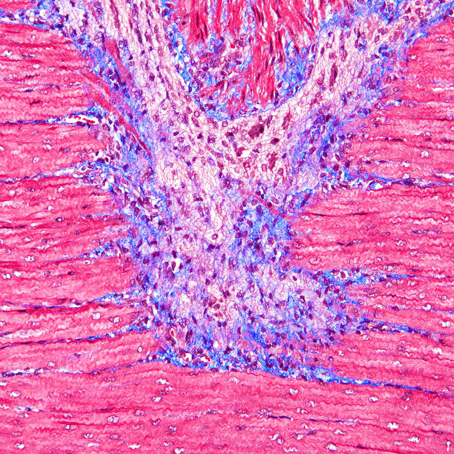 Pig Colon Muscle, Brightfield