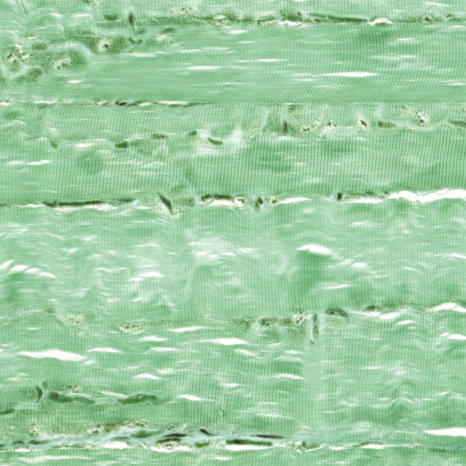 Mouse Skeletal Muscle, Brightfield