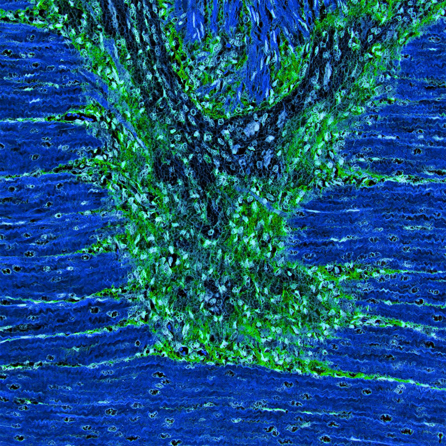 Pig Colon Muscle, Negative