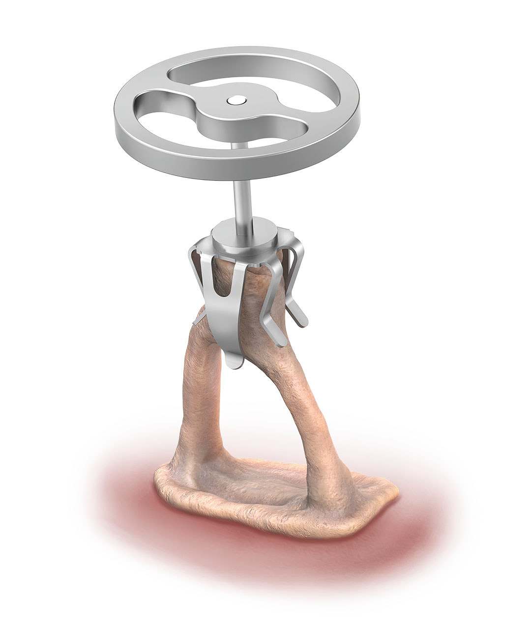 Medical device rendering