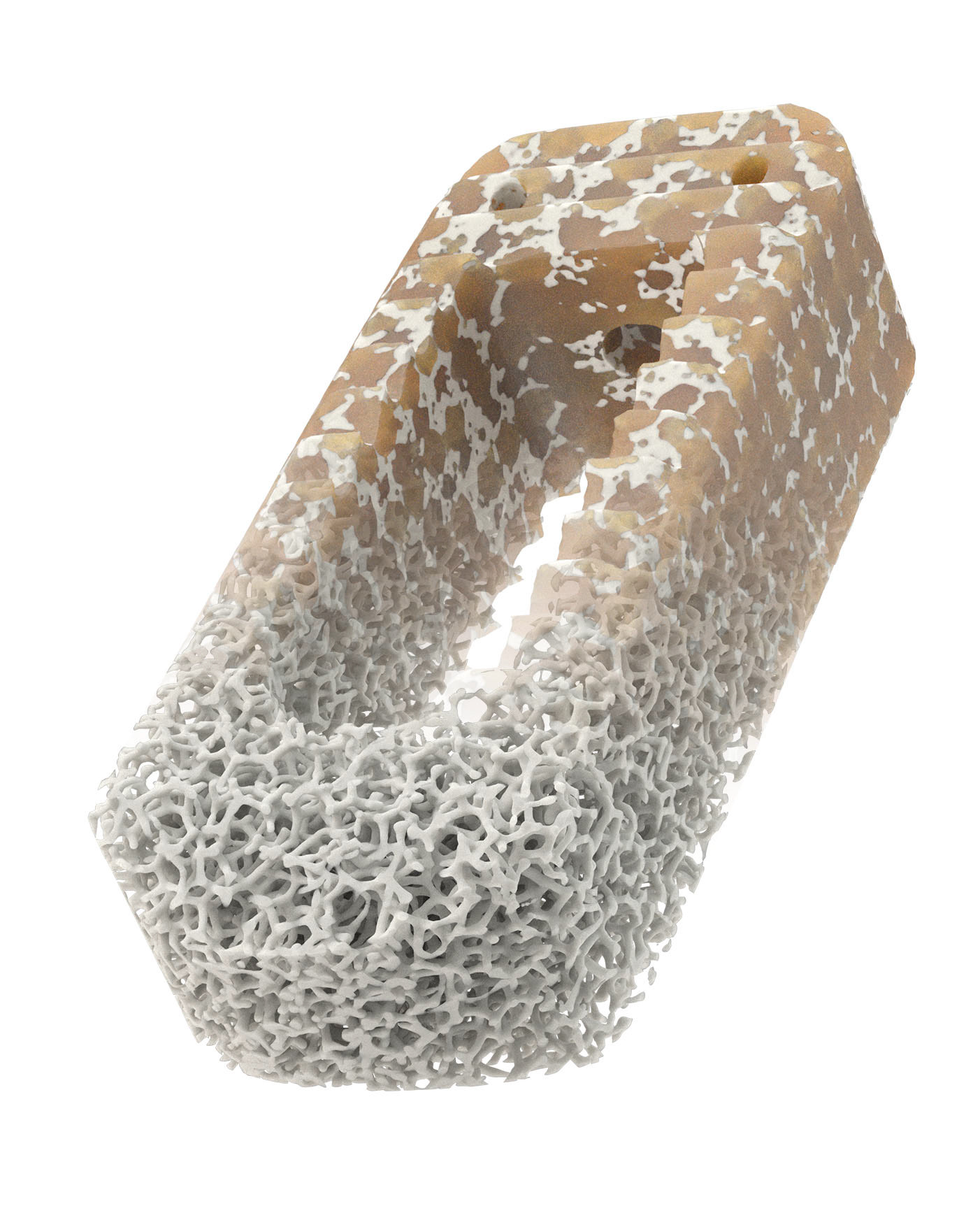 Orthopedic device illustration