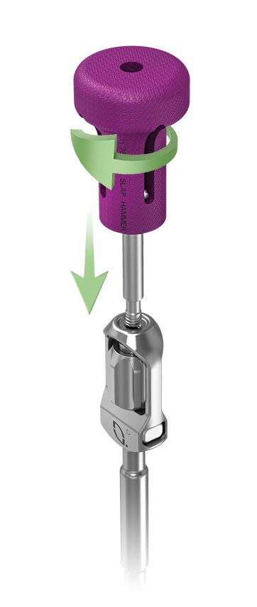 Medical device illustration