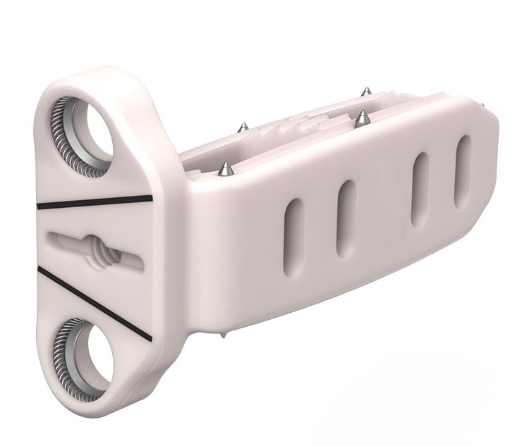 Orthopedic implant illustration