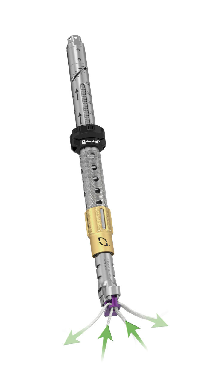 Product illustration