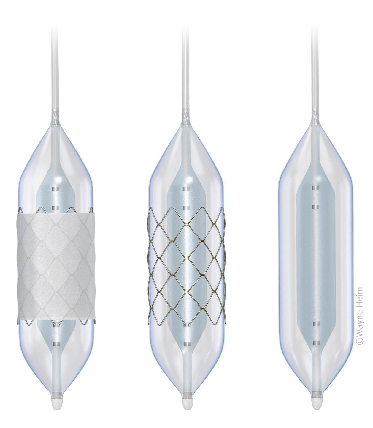 Medical device rendering
