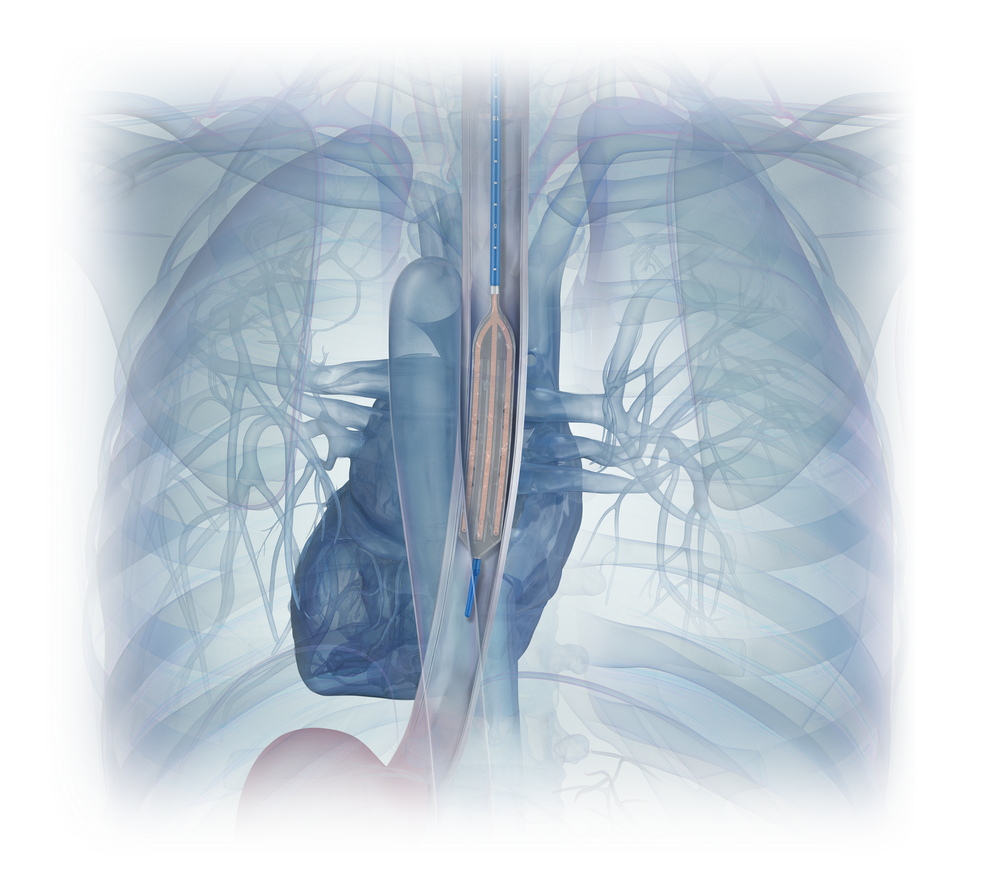 Medical illustration of temperature probe in the esophagus used for advertising and marketing.