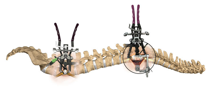 Orthopedic Medical Illustration of human spine by Wayne Heim