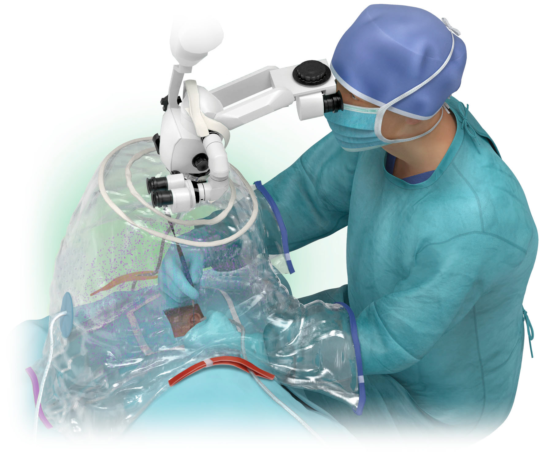 Medical Illustration by certified medical illustrator Wayne Heim showing protective operative covering.