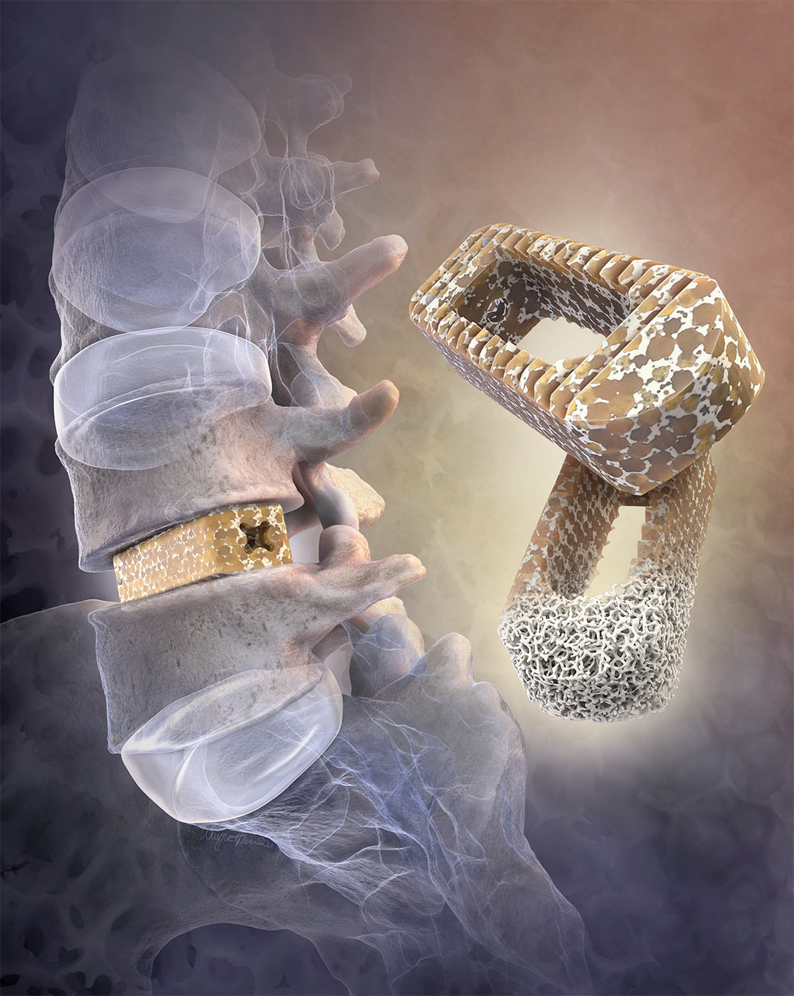2023 Illustration Award: Octane HyperPeek: recently receives award of merit from the Association of Medical Illustrators in their 2023 Salon.
