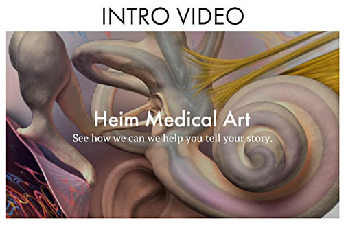 Hire a Medical Illustrator - Certified Medical Artist