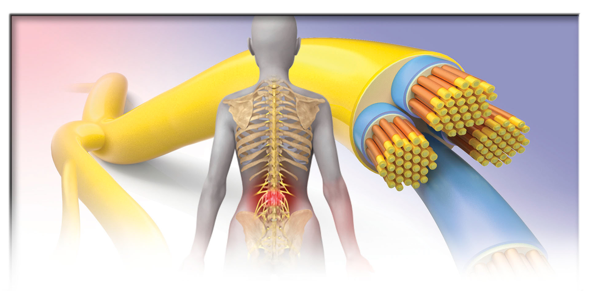Anatomical medical illustration of back pain and nerves. © Wayne Heim