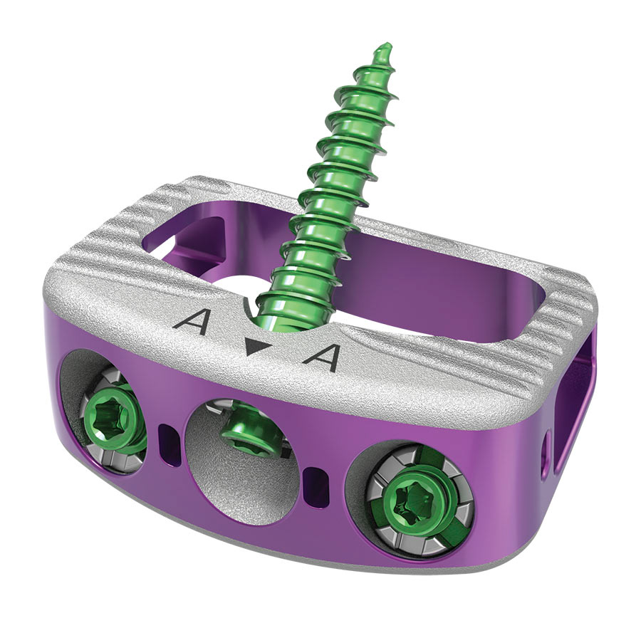 Orthopedic device illustration