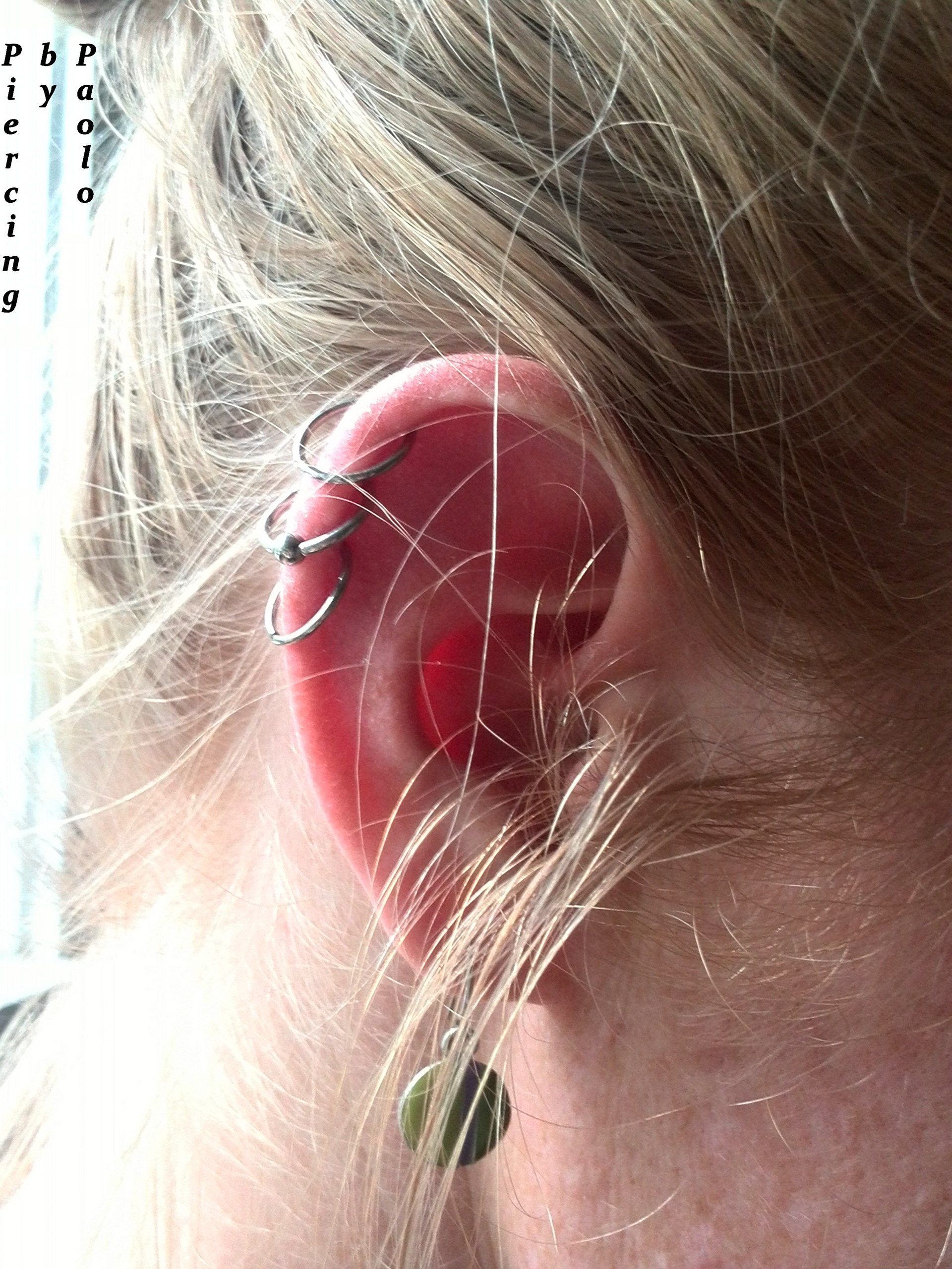 2x Helix (lower 2) healed + new seamless rings