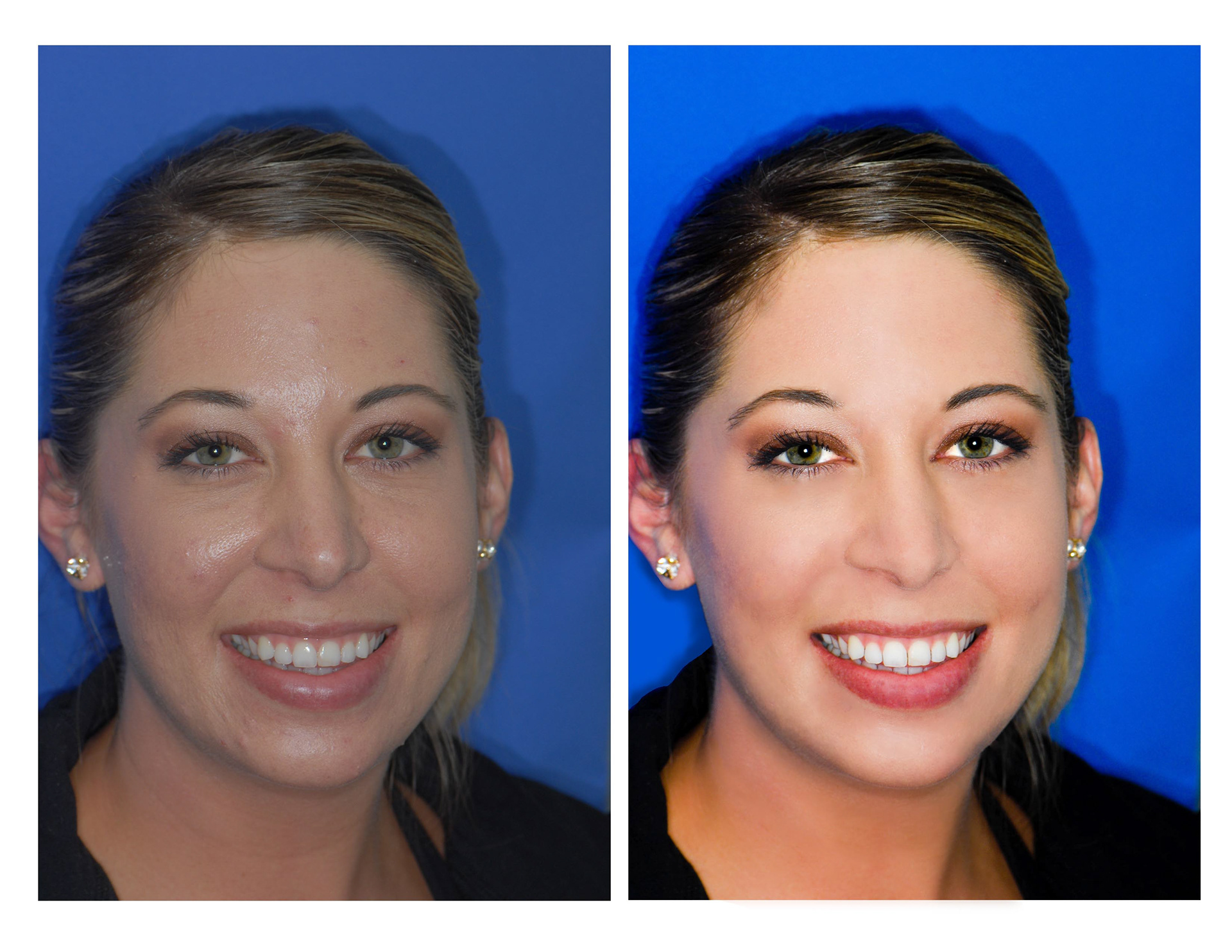 Photo enhancing for Dr. Sam Romano, DMD, MAGD